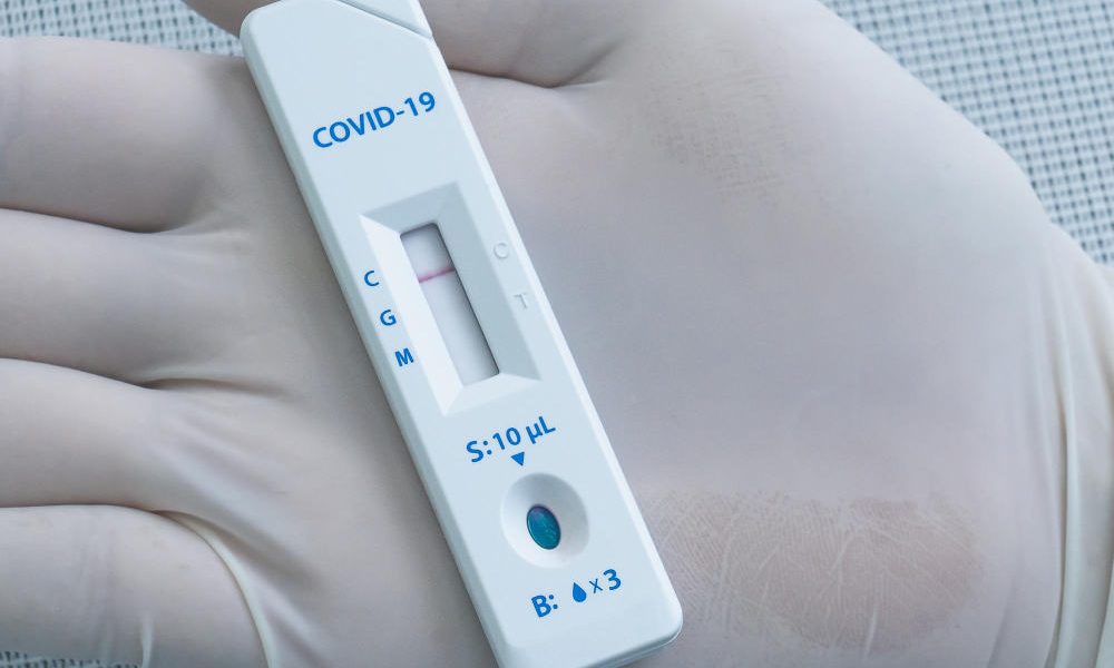 negative-test-result-by-using-rapid-test-covid-19-concept-new-normal